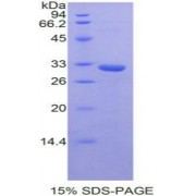 SDS-PAGE analysis of Mouse STAM Binding Protein.