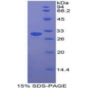 SDS-PAGE analysis of Human STAM Binding Protein.