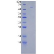 SDS-PAGE analysis of Human Stanniocalcin 1 Protein.