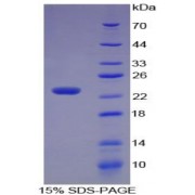 SDS-PAGE analysis of Human Stathmin 1 Protein.