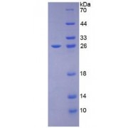 SDS-PAGE analysis of Rat Stem Cell Factor Protein.
