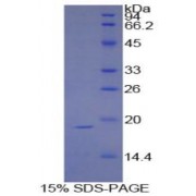 SDS-PAGE analysis of recombinant Human Sucrase Isomaltase Protein.