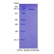 SDS-PAGE analysis of Human Sulfatase 2 Protein.