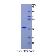 SDS-PAGE analysis of recombinant Human SOD1 Protein.
