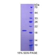 SDS-PAGE analysis of recombinant Mouse SOD1 Protein.