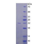 SDS-PAGE analysis of Human Survivin Protein.