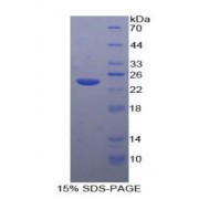 SDS-PAGE analysis of Human Tachykinin Receptor 2 Protein.