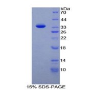 SDS-PAGE analysis of Human TAF1 Protein.