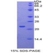 SDS-PAGE analysis of Human TAF12 Protein.