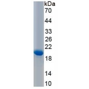 SDS-PAGE analysis of recombinant Rat Tenascin C Protein.
