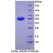 SDS-PAGE analysis of Mouse TXNRD1 Protein.