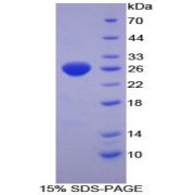 SDS-PAGE analysis of Mouse TXNRD1 Protein.