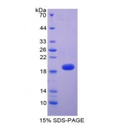 SDS-PAGE analysis of Human Thrombomodulin Protein.