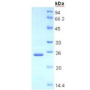 SDS-PAGE analysis of recombinant Human Thrombospondin 1 Protein.
