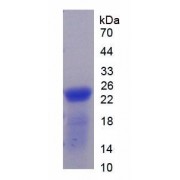 SDS-PAGE analysis of Rat Thrombospondin 1 Protein.
