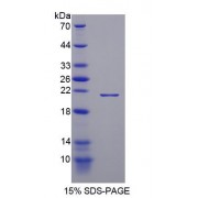 SDS-PAGE analysis of Mouse Thrombospondin 1 Protein.