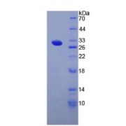 SDS-PAGE analysis of recombinant Human Thyroglobulin Protein.