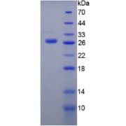 SDS-PAGE analysis of Mouse Thyroglobulin Protein.