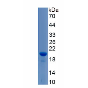 SDS-PAGE analysis of Rat Thyroid Peroxidase Protein.