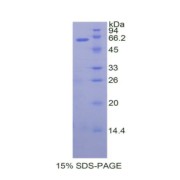 SDS-PAGE analysis of Human TFPI Protein.