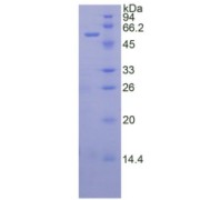 SDS-PAGE analysis of Human TFPI Protein.