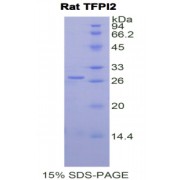 SDS-PAGE analysis of Rat TFPI2 Protein.