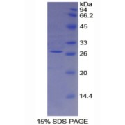 SDS-PAGE analysis of Mouse TFPI2 Protein.
