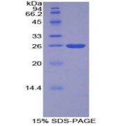 SDS-PAGE analysis of Cow TFPI2 Protein.