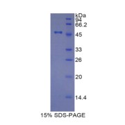 SDS-PAGE analysis of Pig TIMP4 Protein.