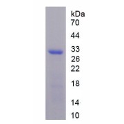 SDS-PAGE analysis of recombinant Human Toll Like Receptor 1 (TLR1) Protein.