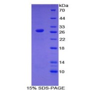 SDS-PAGE analysis of Human Toll Like Receptor 6 Protein.