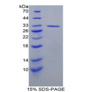 SDS-PAGE analysis of Rat Topoisomerase II Protein.