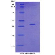 SDS-PAGE analysis of Mouse Topoisomerase II beta Protein.