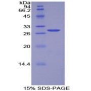 SDS-PAGE analysis of Human TOR1AIP2 Protein.