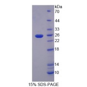 SDS-PAGE analysis of recombinant Pig Transferrin Protein.