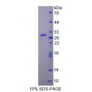 SDS-PAGE analysis of Mouse TFR2 Protein.