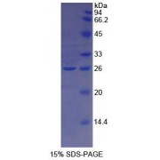 SDS-PAGE analysis of Human TFR2 Protein.