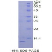 SDS-PAGE analysis of Human TGFa Protein.