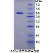 SDS-PAGE analysis of Rat TGFbR3 Protein.