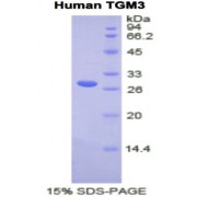 SDS-PAGE analysis of Human TGM3 Protein.