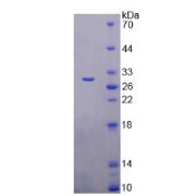 SDS-PAGE analysis of Human TMEM173 Protein.