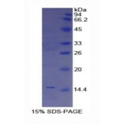 SDS-PAGE analysis of Human Trefoil Factor 2 Protein.