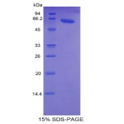 SDS-PAGE analysis of Human TNNC2 Protein.