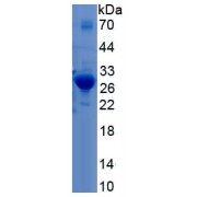 SDS-PAGE analysis of recombinant Rat Troponin I Type 3, Cardiac Protein.