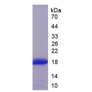 SDS-PAGE analysis of Human TNNT3 Protein.