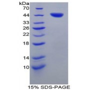 SDS-PAGE analysis of Pig Tryptase Protein.