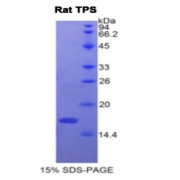 SDS-PAGE analysis of Rat Tryptase Alpha / Beta-1 Protein.