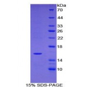 SDS-PAGE analysis of Human Tryptase delta 1 Protein.