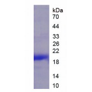 SDS-PAGE analysis of Human Tryptase Gamma 1 (TPSg1) Protein.