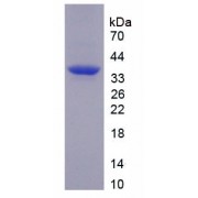 SDS-PAGE analysis of recombinant Human TNIP2 Protein.